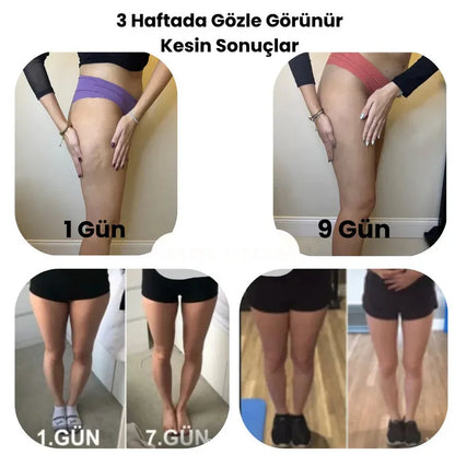 Mağazam Modaven - Bacak İncelten Masaj Aleti